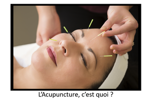 L'Acupuncture, c'est quoi ?